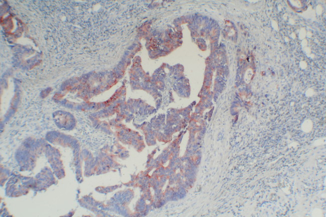 Mouse Probe HRP Labeling Kit with AEC