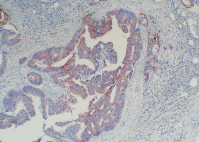 Mouse Probe HRP Labeling Kit with AEC