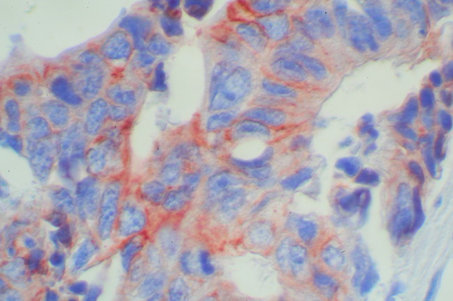 Mouse/Rabbit Probe HRP Labeling Kit with AEC