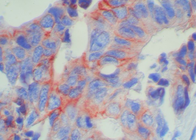 Mouse/Rabbit Probe HRP Labeling Kit with AEC