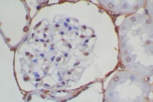 Mouse/Rabbit Probe HRP Labeling Kit with DAB Brown