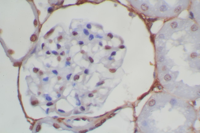 Mouse/Rabbit Probe HRP Labeling Kit with DAB Brown