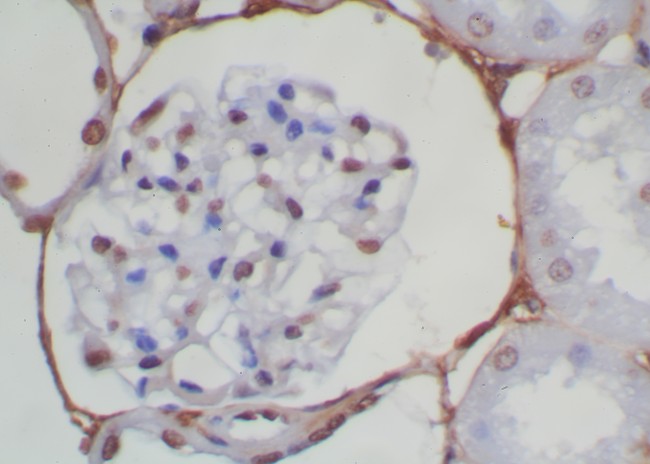 Mouse/Rabbit Probe HRP Labeling Kit with DAB Brown