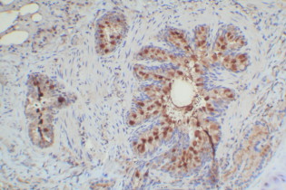 Mouse Probe HRP Labeling Kit with DAB Brown