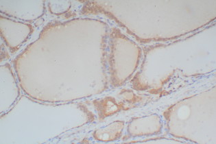 Rabbit Probe HRP Labeling Kit with DAB Brown