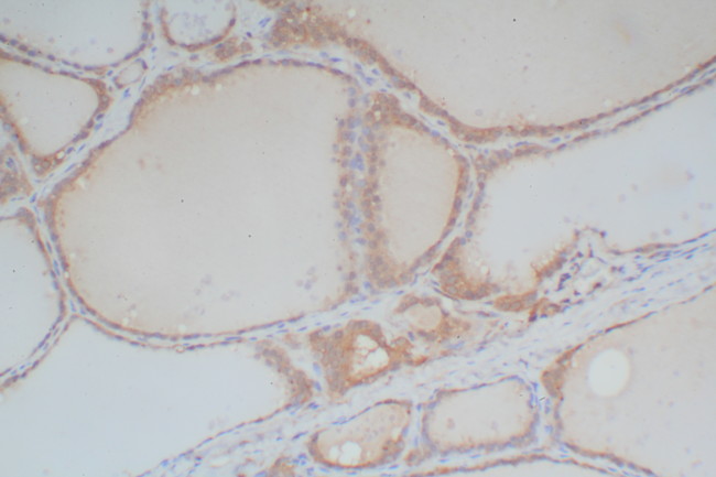 Rabbit Probe HRP Labeling Kit with DAB Brown