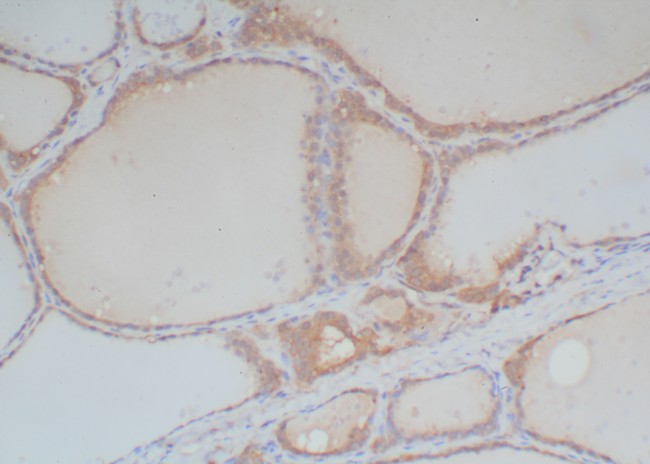 Rabbit Probe HRP Labeling Kit with DAB Brown