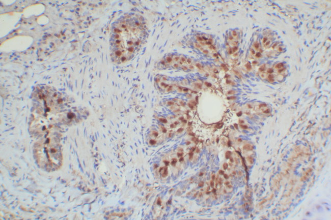 Mouse Probe HRP Labeling Kit with DAB Brown