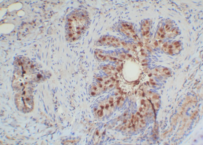 Mouse Probe HRP Labeling Kit with DAB Brown