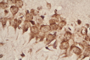 BioSpot ISH Kit For DIG probe figure 2