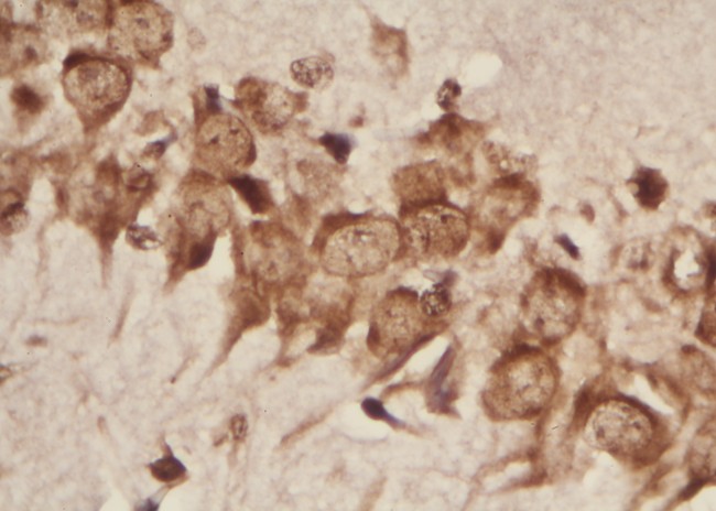 BioSpot ISH Kit For DIG probe figure 2