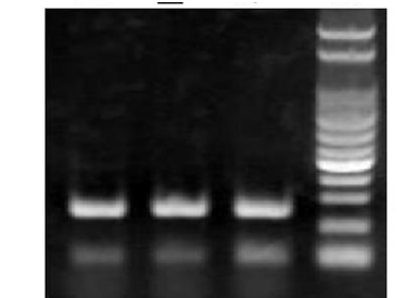 M-MLV reverse transcriptase H-