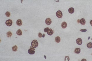 TUNEL In Situ Cell Death Detection Kits