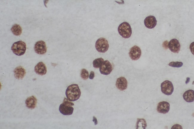 TUNEL In Situ Cell Death Detection Kits