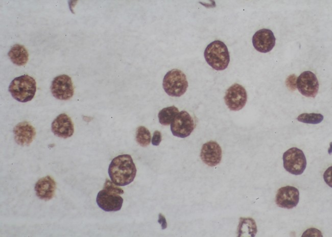 TUNEL In Situ Cell Death Detection Kits